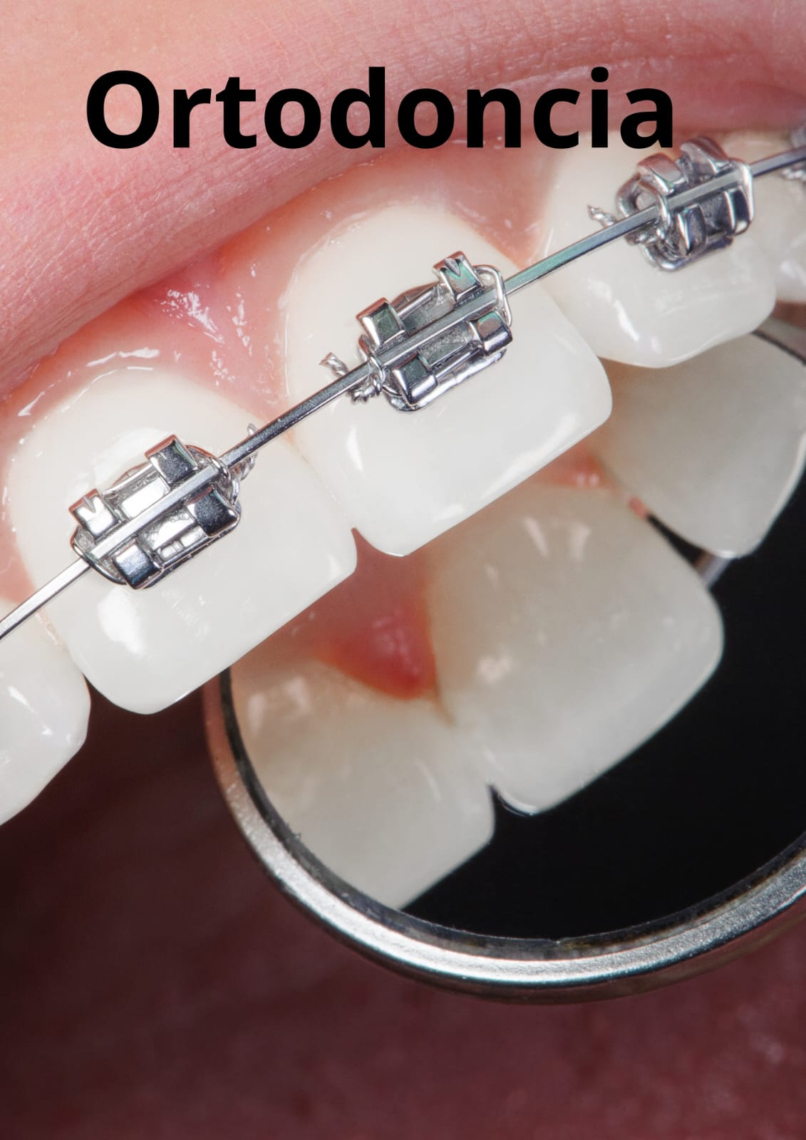 Estética dental - resultado